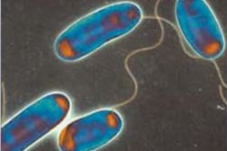 Two Legionella Deaths on Costa Blanca