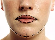Cosmetic Surgery in Spain Cosmetic Surgery in Spain