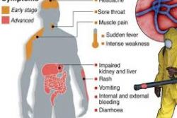 Spain nurse tests positive for Ebola Spain nurse tests positive for Ebola