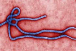 Four hospitalized in Spain after first Ebola transmission outside Africa Four hospitalized in Spain after first Ebola transmission outside Africa